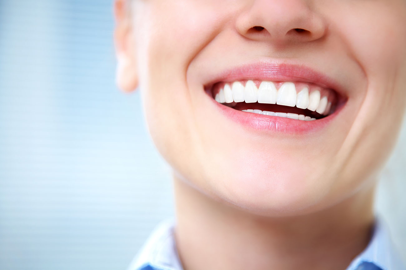 best teeth whitening kits